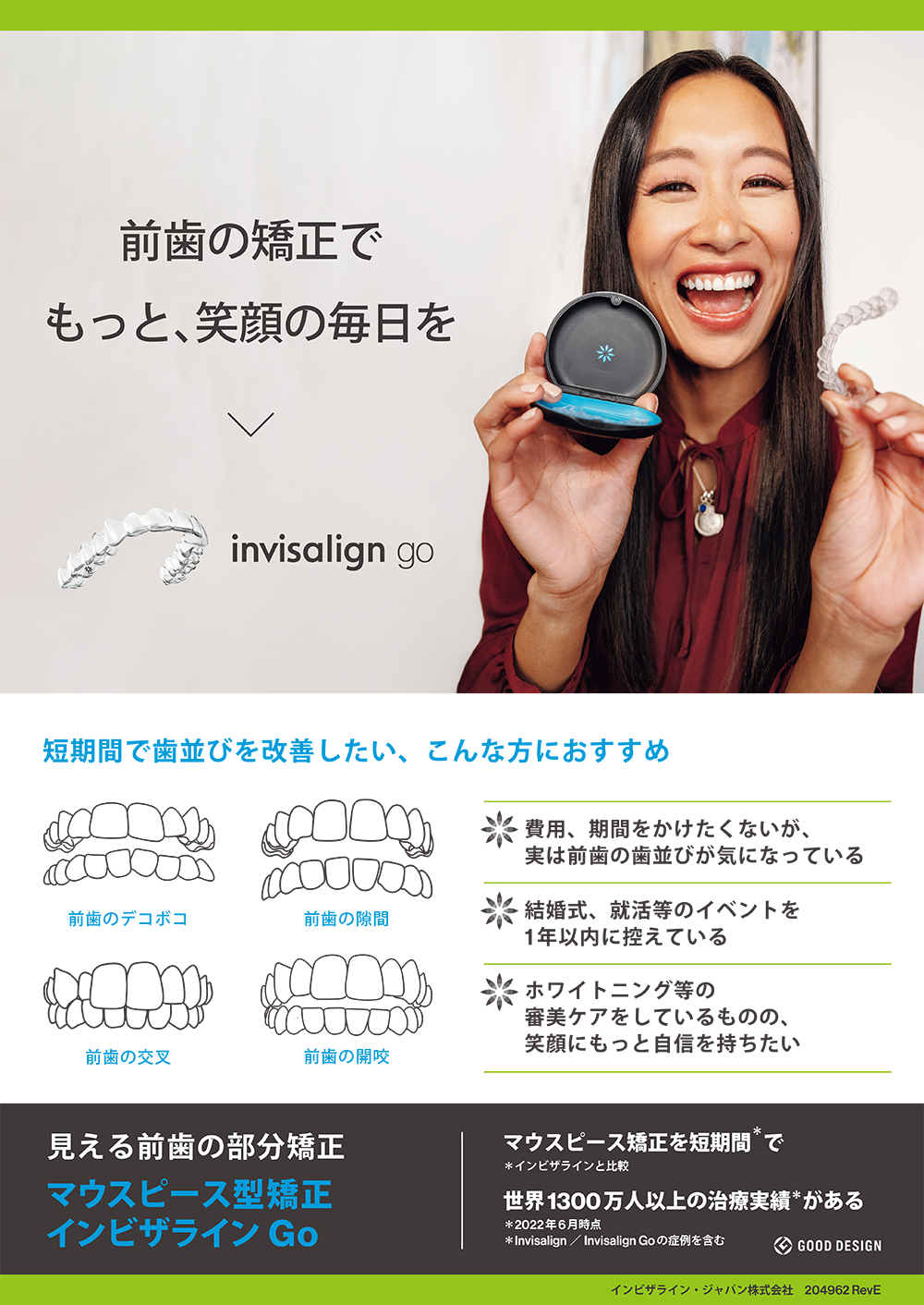 マウスピース矯正