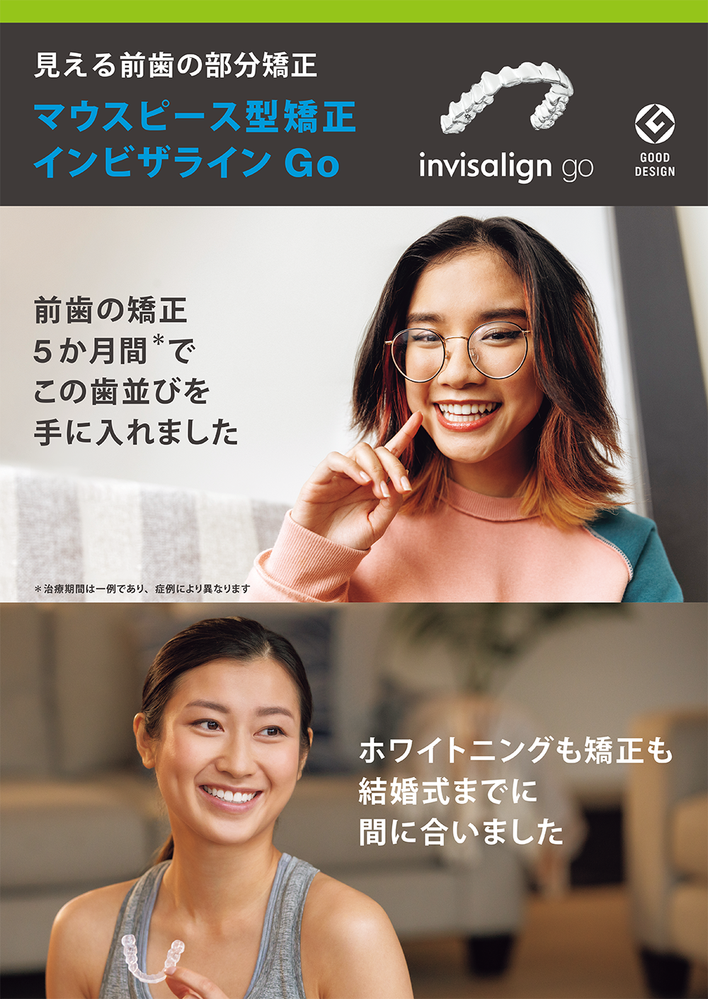 マウスピース矯正